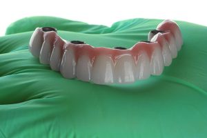 a full arch of teeth with 4 holes for tooth implants to place it into the jaw