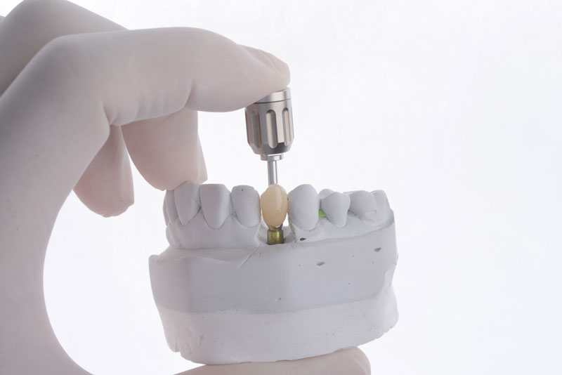a single dental implant with a tool to place it being shown