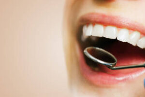 dentist examine womans teeth.