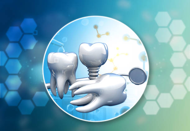 Human dental implant concept background.